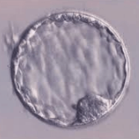 Alteraciones genéticas embrionarias